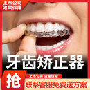 蓉尔F2牙齿矫正器隐形牙套正畸龅牙缝透明成人儿童定制矫正神器矫治器 上下牙一期+矫正综合方案服务