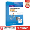 冠状动脉造影读片技巧图解 正常及异常造影 教你从冠脉造影小白 快速进阶PCI达人