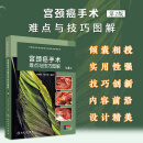 宫颈癌手术难点与技巧图解（第2版）