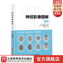 神经影像图解第2版