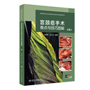 宫颈癌手术难点与技巧图解（第2版）