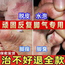 乐家老铺南京同仁堂去脚气脚臭舒缓止痒脚皮烂臭真菌感染皮肤抑菌