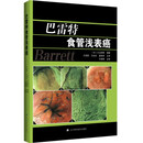 巴雷特食管浅表癌 [日]小山恒男著,王亚雷,王永东,夏海萍 译 辽宁科学技术出版社