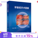 卵巢癌手术图解 9787117359573