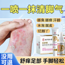 同仁堂脚气喷剂止痒脱皮脚汗水泡型脚痒脚臭汗喷雾狼毒喷剂60ML+20ML