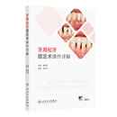 牙周松牙固定术操作详解