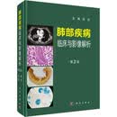 肺部疾病临床与影像解析 第2版 科学出版社 张嵩 编 新华正版书籍包邮 图书