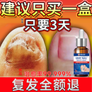 香港大药房  重度灰指甲100%特效专用的药特殊效专用抑菌液灰甲净套装 一盒【特效套装】1-2个灰甲选 灰指甲100%特效专用的药第一名