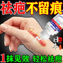 宫本田中祛疤痕修复凝胶剖腹产祛疤祛痘印去黑色素沉淀摔伤修复增生性疤痕 单盒【限时秒杀】新疤旧疤都能消 祛疤膏祛痘印痘坑修复