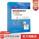 冠状动脉造影读片技巧图解 正常及异常造影 教你从冠脉造影小白 快速进阶PCI达人