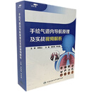 【极速发货】手绘气道内导航原理及实战视频解析主编李时悦钟长镐主审钟南山阐述手绘气管内导航技术原理胸部CT识别径向超声26个病例移动U盘版 （移动U盘）手绘气道内导航原理及实战视频解析