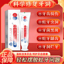 蛀牙洞修膏复龋齿烂牙坏洞儿童成人防蛀牙膏治疗清理牙虫的药医用 一盒/100g【富人的牙膏】