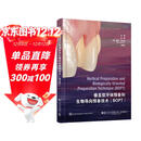 垂直型牙体预备和生物导向预备技术（BOPT）