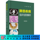 肺部疾病临床与影像解析（第二版）