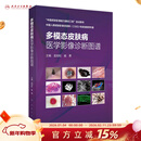多模态皮肤病医学影像诊断图谱 孟如松崔勇主编 2021年1月参考书