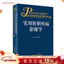 实用肝胆疾病影像学 2023年4月参考书 9787117322072 人民卫生出版社