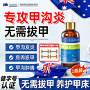 Layanana澳洲甲沟炎专用保健液非药治脚趾甲往肉长消肿痛息肉嵌甲外用30ml