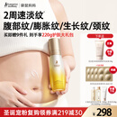 袋鼠妈妈准孕妇妊娠油乳双萃小金瓶抚纹精华乳淡化纹路专用橄榄油100ml