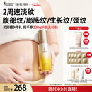 袋鼠妈妈准孕妇妊娠油双萃小金瓶抚纹精华乳淡纹护肤专用妊娠纹油乳100ml