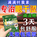 邹翳方眼药水缓解疲劳熬夜玩手机用眼过度医用滴眼液眼干眼涩改善视力 【超值换购秒杀】眼干眼涩眼疲劳