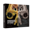高精度眼耳鼻颅底冠状面断层解剖与CT对照图谱