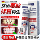 FALRUIER德国牙龈萎缩专用牙膏修复再生护龈固齿牙齿松动牙周根炎外露150g