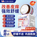 守诚堂制药湿疹膏止痒皮肤瘙痒红肿皮炎湿疹痤疮感染非药膏1盒装