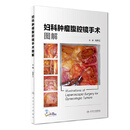 妇科肿瘤腹腔镜手术图解 刘开江 人民卫生出版社 9787117271066