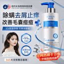 JOBALIN二硫化硒洗发水医用脂溢性皮毛囊炎专用洗剂去屑止痒水杨酸女控油