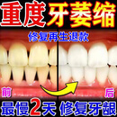 MOIHANR德国牙膏I护龈固齿牙龈I萎缩修复再I生牙根外露牙周I炎牙齿I松动 2盒装【牙龈|萎缩 修复再生 肿痛出血】