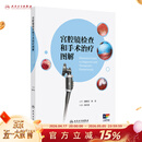 宫腔镜检查和手术治疗图解