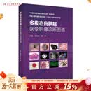 多模态皮肤病医学影像诊断图谱 孟如松崔勇主编 2021年1月参考书