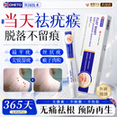 OHETO去疣疣体脱落膏扁平疣专用丝状疣尖锐湿疣跖疣去除脖子小肉粒1盒