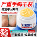 BEAI皲裂脚裂膏脚后跟防干裂龟裂开裂冻裂护手足秋冬起硬皮保湿润肤霜