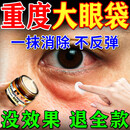 SOURNN去大眼袋严重中老年专用眼袋霜消除重度男女士眼袋贴祛去除神器膜 医用眼霜【贵／但好用】