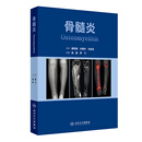 骨髓炎 谢肇罗飞 骨感染创伤生物膜病理生理细菌血清影像学清创技术骨与软组织修复骨缺损重建开放性骨折人民卫生出版社骨科学