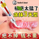 KOCHMEDIZIN诺奖研发去除修复膏凝胶医院专用膏儿童成人通用膏温和修护手肌肤 诺奖研发【疤痕去除修复】英国品牌