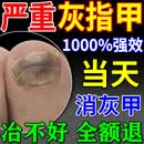 灰指甲专用非药真菌感染指甲增厚发黄变厚亮甲凤仙花灰指甲抑菌液 限时换购秒杀【灰甲液】