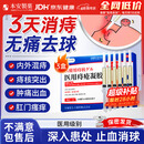 本安制药日本痔疮膏去肉球内外混合专用的药卡波姆痔疮凝胶痔根栓治断 3盒