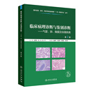 临床病理诊断与鉴别诊断——气管、肺、胸膜及纵隔疾病 第2版 王恩华 张杰 张声 主编 临床医学 9787117398619 人民卫生出版社