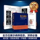 胎儿畸形产前超声诊断学（第2版）李胜利,罗国阳/科学出版社 科学出版社