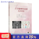 子宫输卵管造影临床图谱