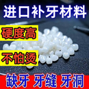 【升级款】补牙材料补缺牙自己动手高硬度补牙材料树脂医用美护z 【原装正品】药房同款 无效包退