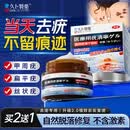 久卜制药扁平疣专用克疣祛疣膏疣体脱落膏丝状疣去除i疣体膏跖疣瘊子 1盒
