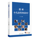 图解小儿晶状体病诊疗