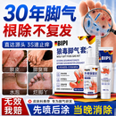 BIPI狼毒脚气止痒脱皮烂脚丫真菌感染根脚臭痒糜烂水泡特治效搭药