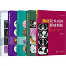 张嵩正版书籍5本 肺部疾病临床与影像解析第2版+肺部细菌感染临床与影像解析+肺部真菌感染+胸部疑难病例影像解析+纵隔肺疾病临床 【主图款】张嵩，全5本
