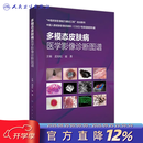 【推荐】多模态皮肤病医学影像诊断图谱皮肤高频超声影像学技术皮肤科临床医学孟如松崔勇病理CSID培训用书人民卫生出版社临床影像医学 多模态皮肤病医学影像诊断图谱