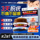 久卜制药扁平疣专用克疣去疣药膏神器丝状疣脖子小肉粒疣体脱落祛疣膏 1盒