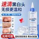 泊紫汀兰B5去黑头导出液粉刺闭口收缩毛孔清理神器深层清洁控油平衡黑头水